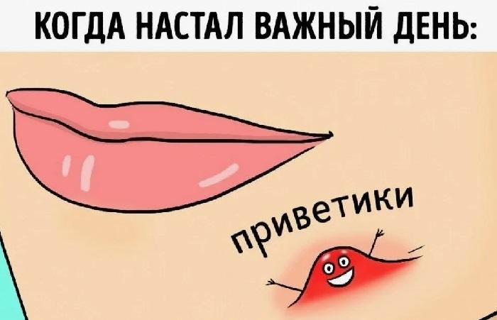 Подробнее о статье Анекдоты про прыщи